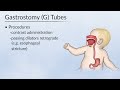 "Indications for Gastrostomy Tube Placement" by Dr. Lindsey Armstrong, for OPENPediatrics