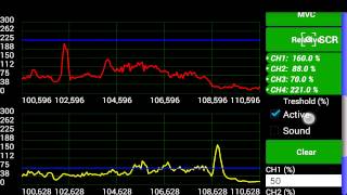 EMG Biofeedback Application