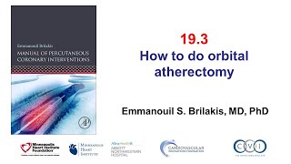 19.3 Orbital atherectomy: Manual of PCI