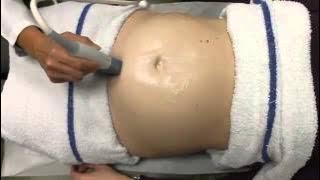 Ultrasound in Obstetrics & Gynecology: A Practical Approach - Clip 10.6