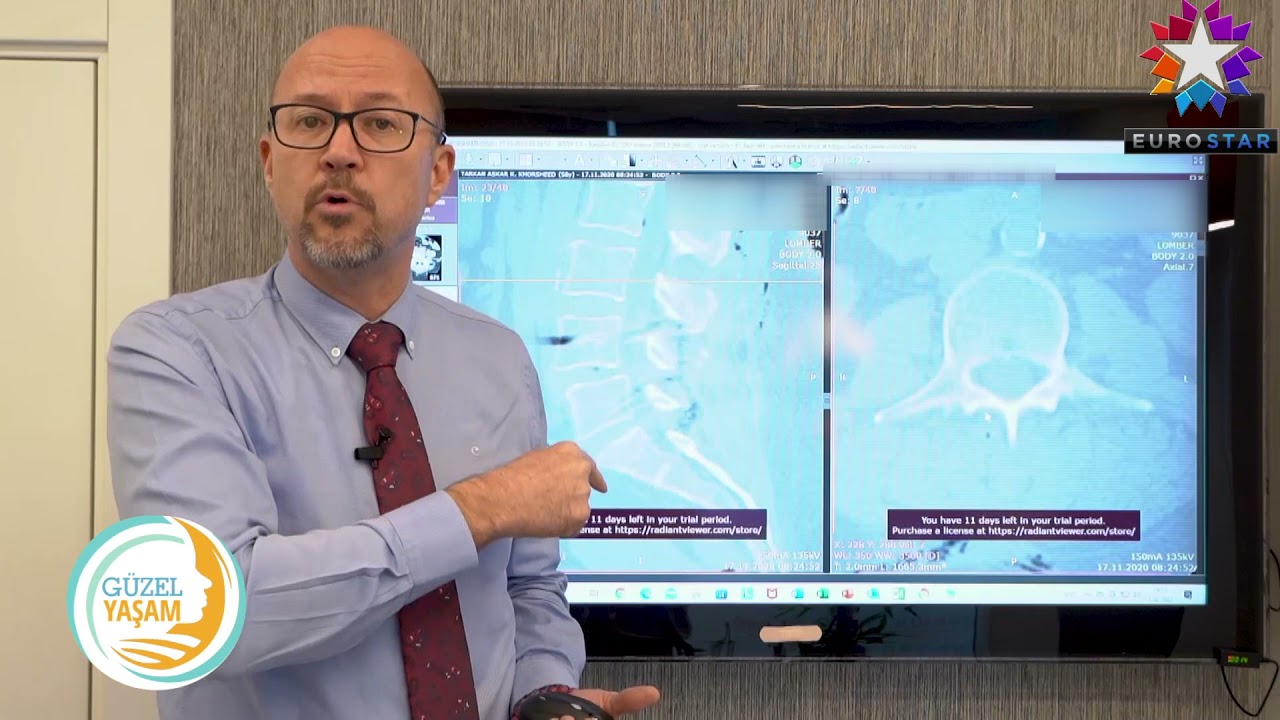 ONUR KULAKSIZOĞLU BEL KAYMASI TEDAVİ YÖNTEMLERİ