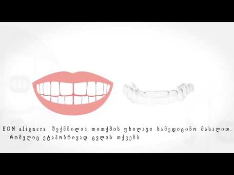 Invisble Braces - გამჭირვალე კაპები   ელაინერები