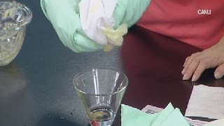 Dr.Feridun Kunak'tan Yanık İzlerine İyi Gelen Yumurta Yağı Tarifi