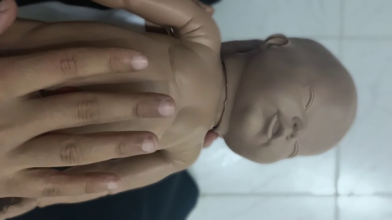 Heimlich maneuver for infant