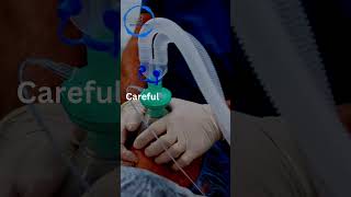 General Anesthesia in OMF Surgery|@artistryindentistry
