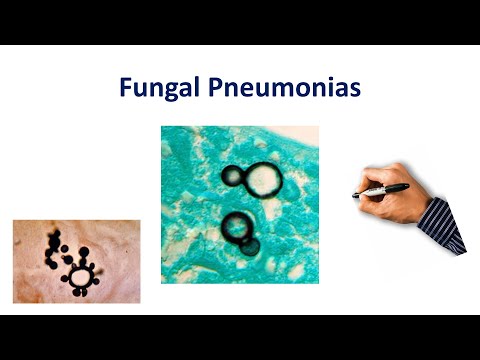 Video: Fungal Pneumonia Sa Ferrets