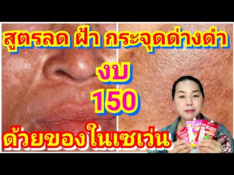 สูตรลดฝ้า กระ หน้าขาวใสด้วยของในเซเว่น งบไม่เกิน 150 บาท |แม่นายมาแชร์