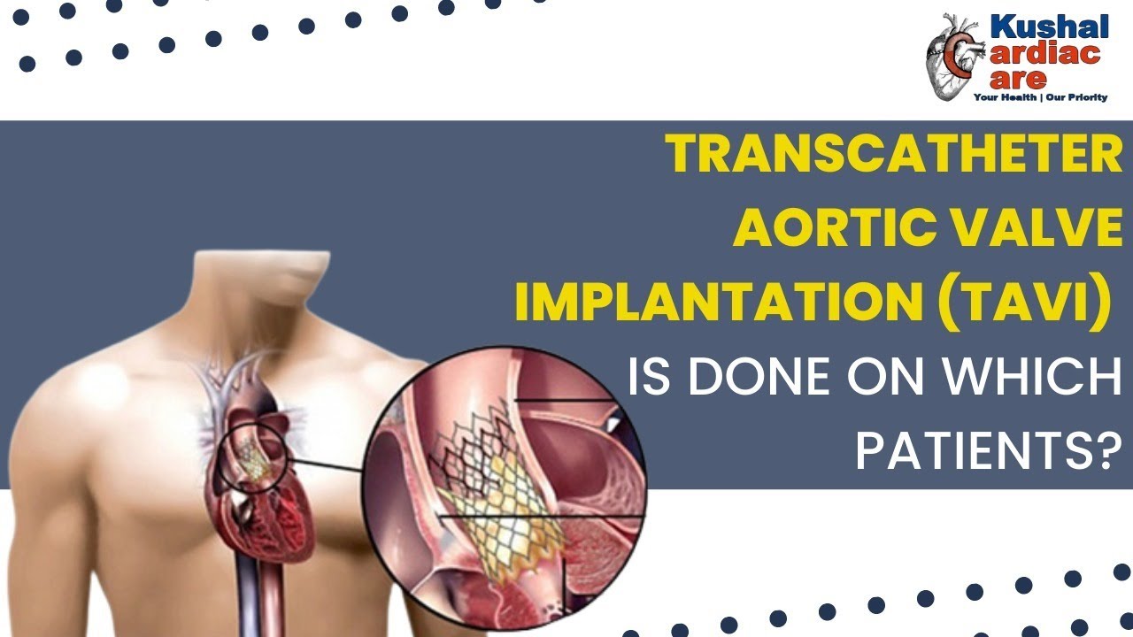 DR. MAYUR JAIN | INTERVENTIONAL CARDIOLOGIST IN THANE | KUSHAL CARDIAC CARE | TAVI | TAVR