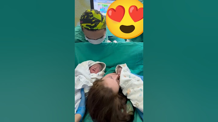 ردة فعل الام والاطباء لما شافوا التوأم 🤩ما شاء الله 🤩