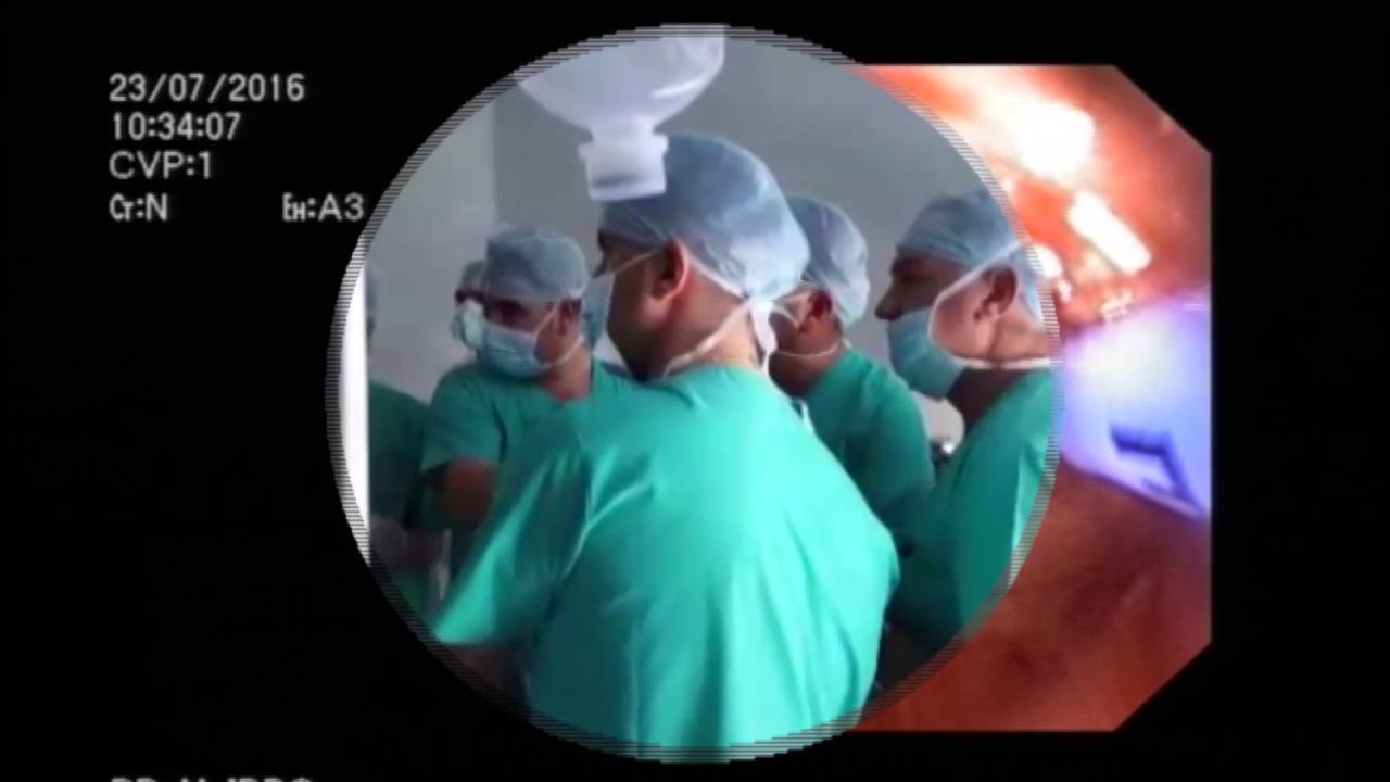 spitali-continental-youtube