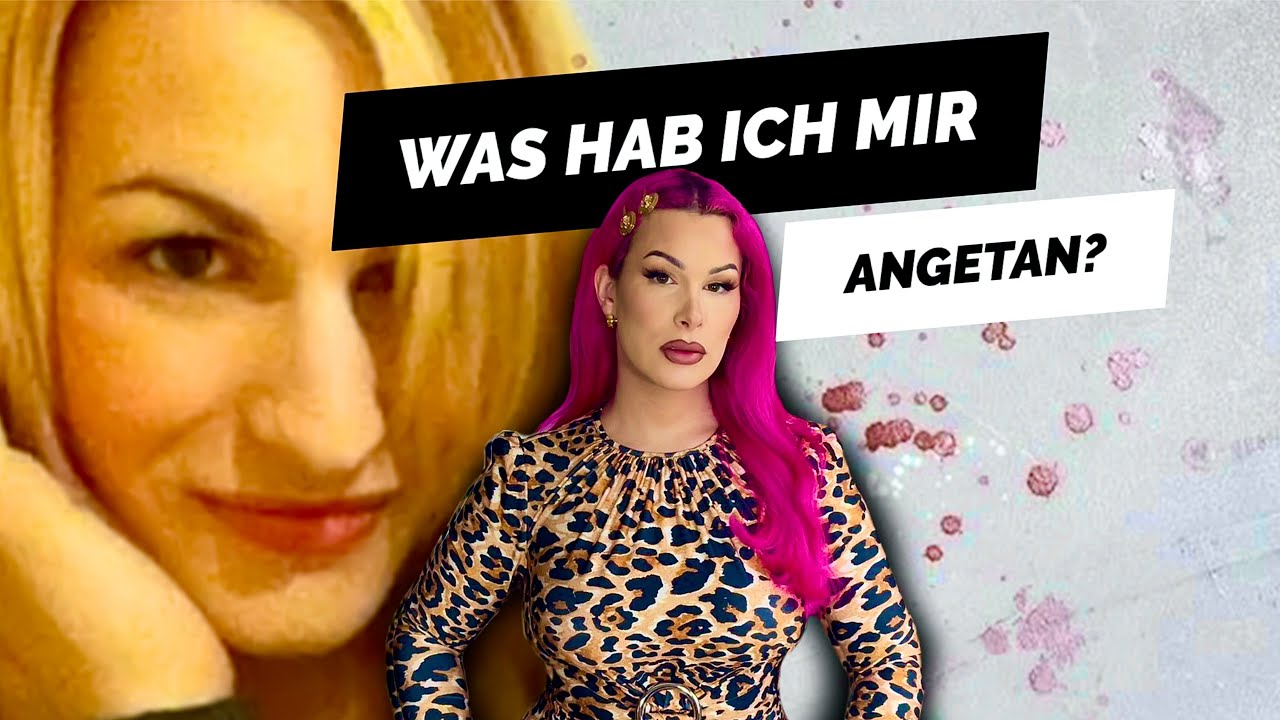 Meine NASENoperation. Eine BLUTIGE Angelegenheit.