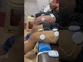 QUAD FUNCTION AFTER ACL surgery /NMES /#physiotherapy #shorts