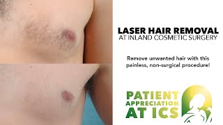 Laser Hair Removal at Inland Cosmetic Surgery