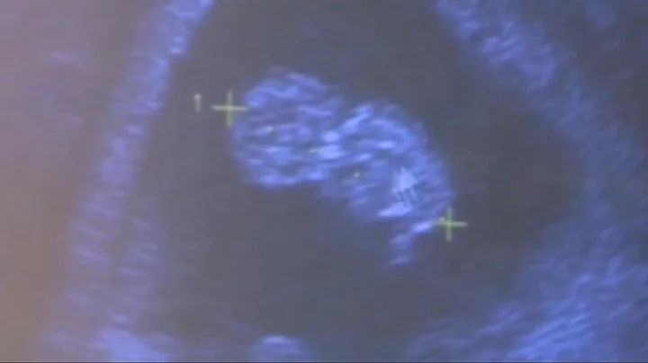 Ohio Heartbeat law now in effect after federal court lifts injunction