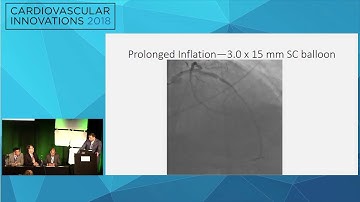 CVI2018 Session: The natural history of perforation - Michael Luna, MD