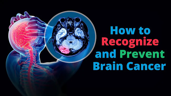 Brain Cancer: Warning Signs and How To Prevent It