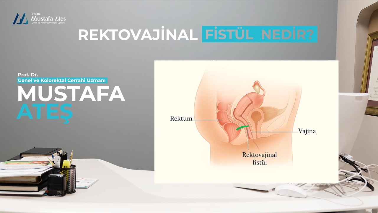 Rektovajinal Fistül Nedir?