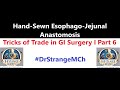 How to Perform Hand-Sewn Esophago-Jejunal Anastomosis | Tricks of Trade GISx 6HD @mayankdixit8023