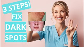 Fix Your Dark Spots In 3 Steps Hyperpigmentation Melasma Skincare Made