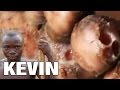 Kevin's Battle With Chigoe Fleas - Rise Up Society to the Rescue!