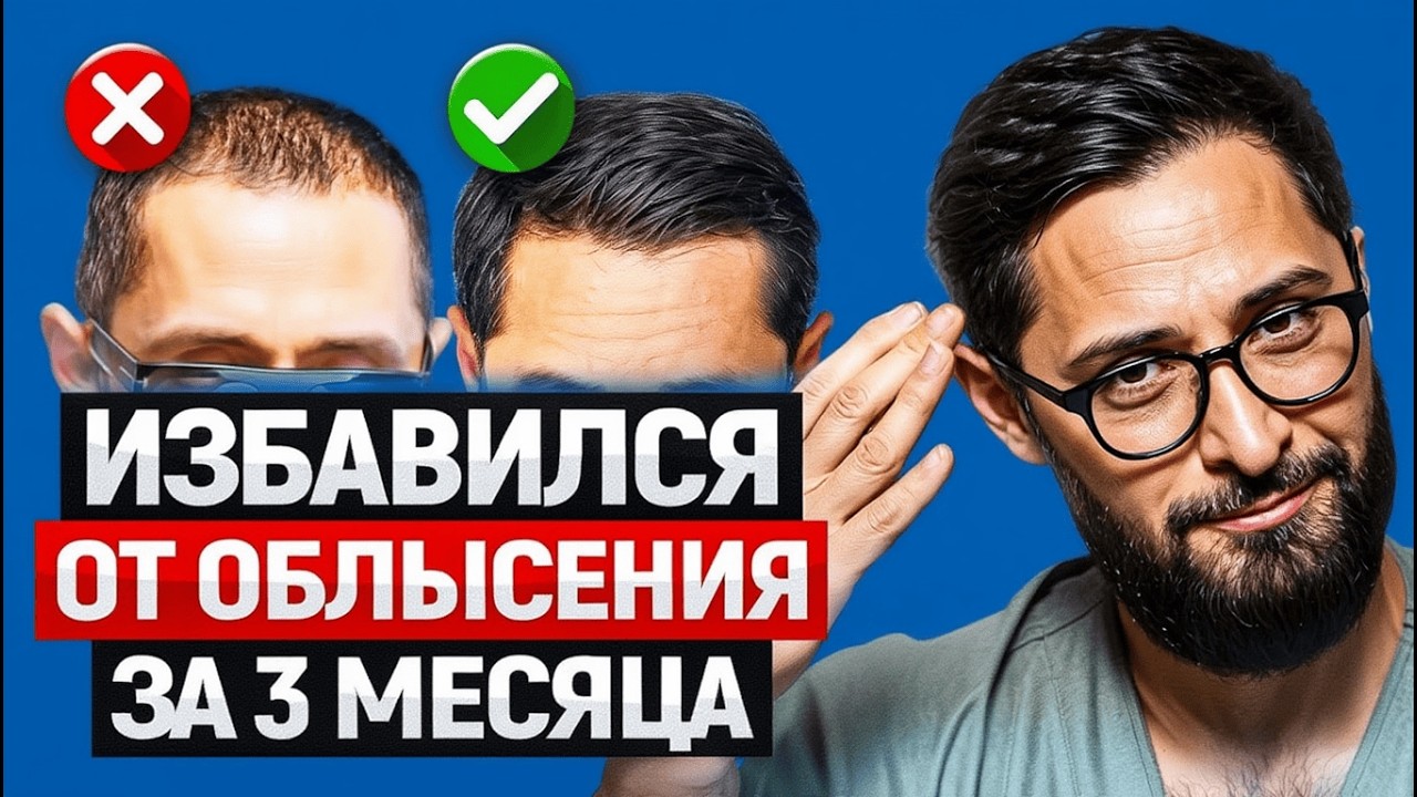 Я почти облысел… Врач о том, как остановить выпадение волос ПРАВДА без мифов