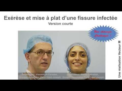 Vidéo: Fissure Anale - Traitement, Chirurgie, Symptômes