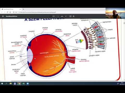 Videó: Hogyan korrigálható a presbyopia?