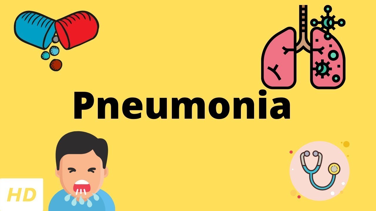 Pneumonia Causes Signs and Symptoms Diagnosis and Treatment