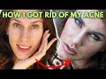 3 Acne Destroying Skincare Tips I Wish I knew When I was 16