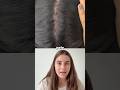 O que acontece se você ficar 1 ANO sem lavar o cabelo?