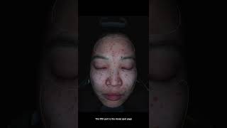 Skin analyzer B3 operate video