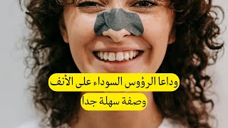 وصفة سريعة لإزالة الرؤوس السوداء من الأنف