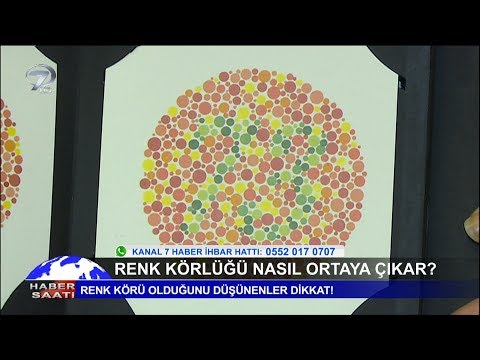 Renk Körlüğü Testi Nedir? Renk Körüğü Nasıl Anlaşılır?