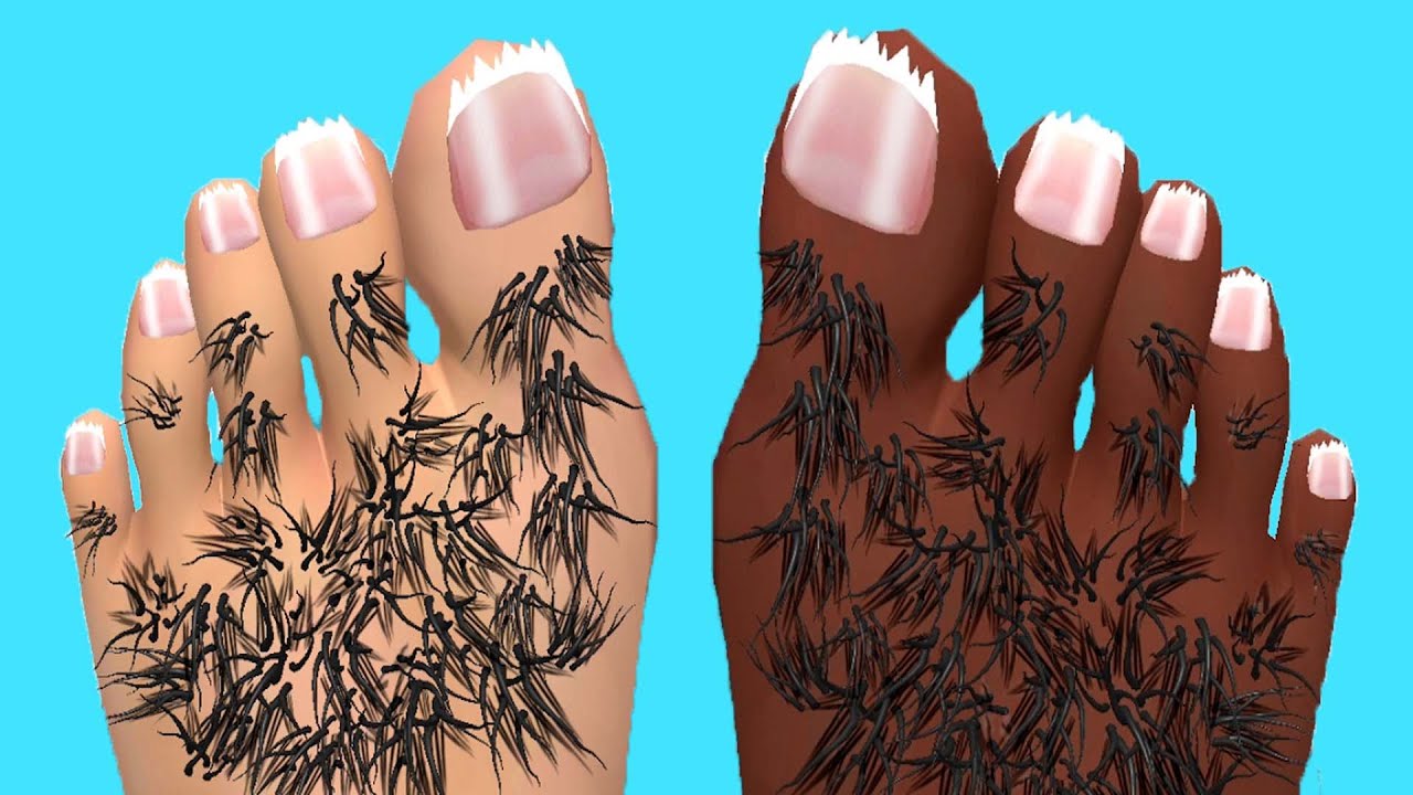 Foot Clinic - Gameplay Walkthrough - All Levels (IOS, Android)