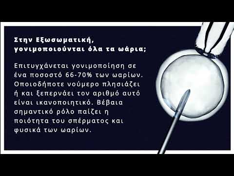 Εξωσωματική Γονιμοποίηση -