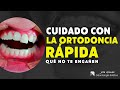 Esto Pasa Con Las Ortodoncias Rápidas No Te Dejes Engañar Odontólogo Bogotá Jota Gómez