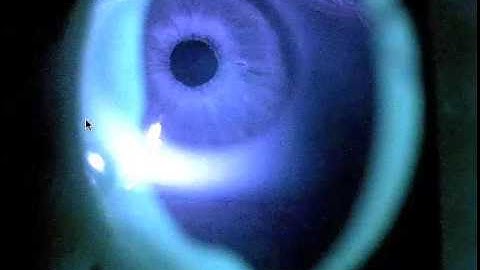 eyetracking hmd test