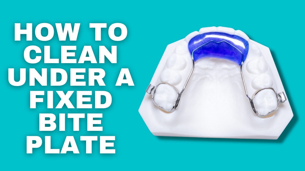 How to Clean Under a Fixed Bite Plate or Any Fixed Appliance YouTube