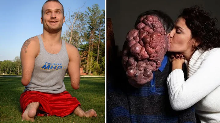 15 Most Shocking People In The World – You Won’t Believe They Exist!