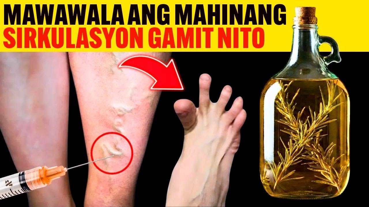 Barikos? Subukan Itong Natural na Gawa sa 2 Simpleng Sangkap—Epektibo Talaga!
