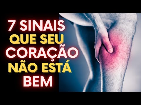 Vídeo: Como fazer as pazes com o herpes: 12 etapas (com fotos)