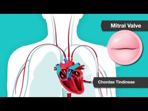 Understanding Heart Murmurs, Aortic and Mitral Valve Problems