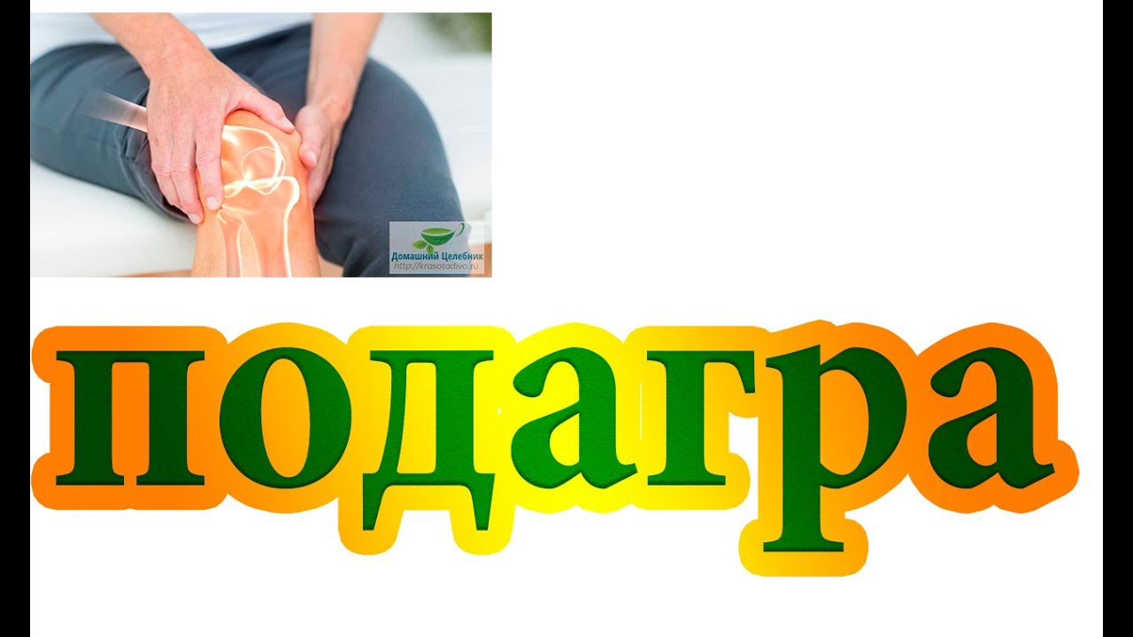 Подагра.Подагрический артрит.Лечение приступа подагры - YouTube