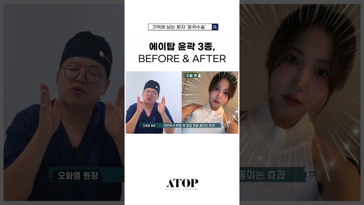 Эйтоп гоо сайхны мэс заслын клиник. Мартагдашгүй нүүрний контур мэс заслын үйлчлүүлэгч! Эйтоп нүүрний контур 3 төрөл!