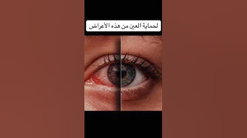 كيف نحمي أعيننا من أضرار لبس العدسات اللاصقة