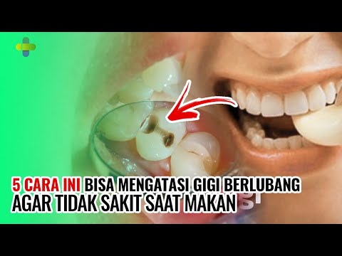 Video: Cara Makan Makanan Keras Saat Gigi Sakit: 11 Langkah