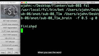 9 3 3 3 ENIGMAU FSL fMRI1 CC