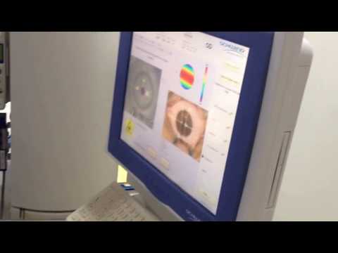 عملية تصحيح النظر بالليزر بأسرع جهاز ليزك الدكتور أشرف الهزايمة في المستشفى التخصصي الطبي في الرياض