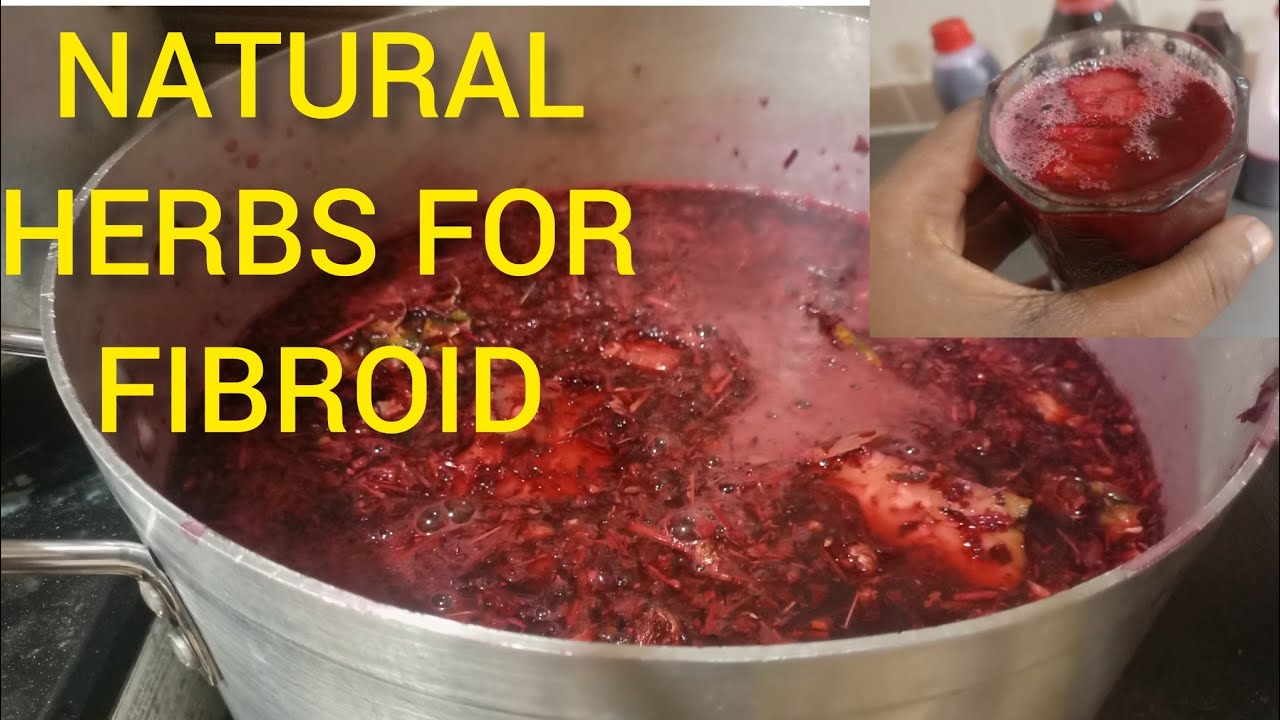 Powerful Natural remedy to shrink fibroid - YouTube