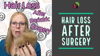 Hair Loss After Bariatric Surgery | My Gastric Bypass Journey